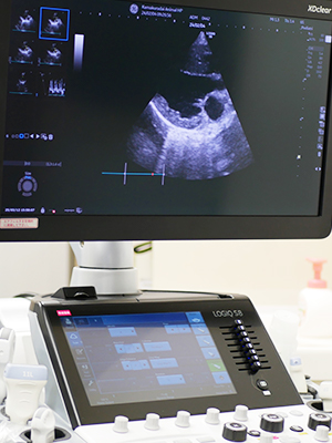 超音波診断装置